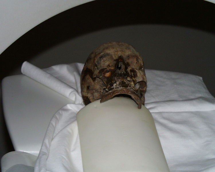 Файл:Tsar family expertise tomography 8.jpg