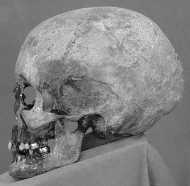 Файл:Tsar family expertise skulls 7a.jpg