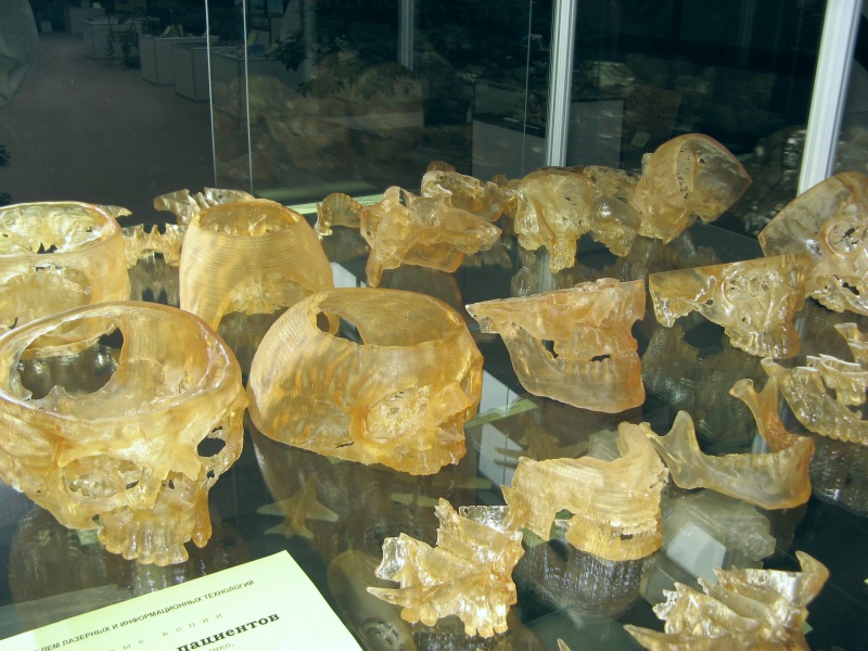 Файл:Стереолитография хирургия ИПЛИТ.jpg