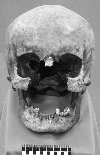 Файл:Tsar family expertise skulls 1.jpg